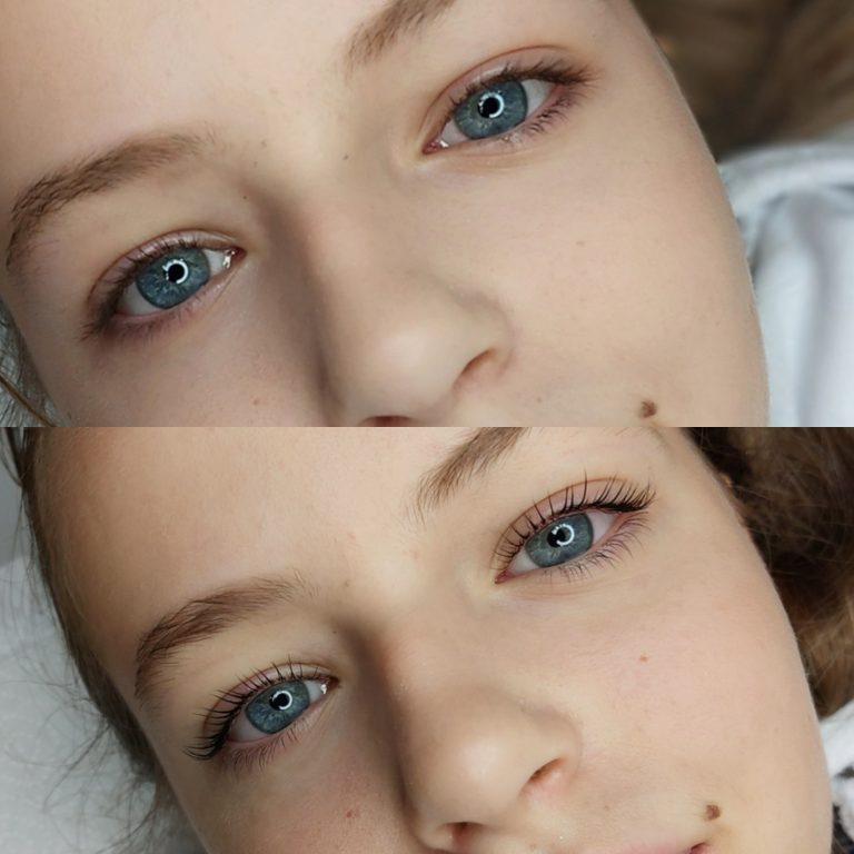 Előtte/Utána